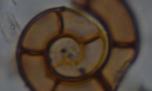 Brett Parbus: "I'm Spiraling:" This little guy is a species of single-celled organisms called foraminifera. They only live in saltwater environments and despite creating relatively complex shells similar to mollusks, are only about the size of a white blood cell! 