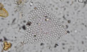 Brett Parbus: "The Underlying Symmetry:" This mesmerizing creature is what is known as a diatom, a microscopic microalgae sometimes called the "jewel of the sea" due to its opalescent colors and satisfying geometry. Fun fact: diatoms generate roughly half of all the oxygen on the planet! I just think they're neat!